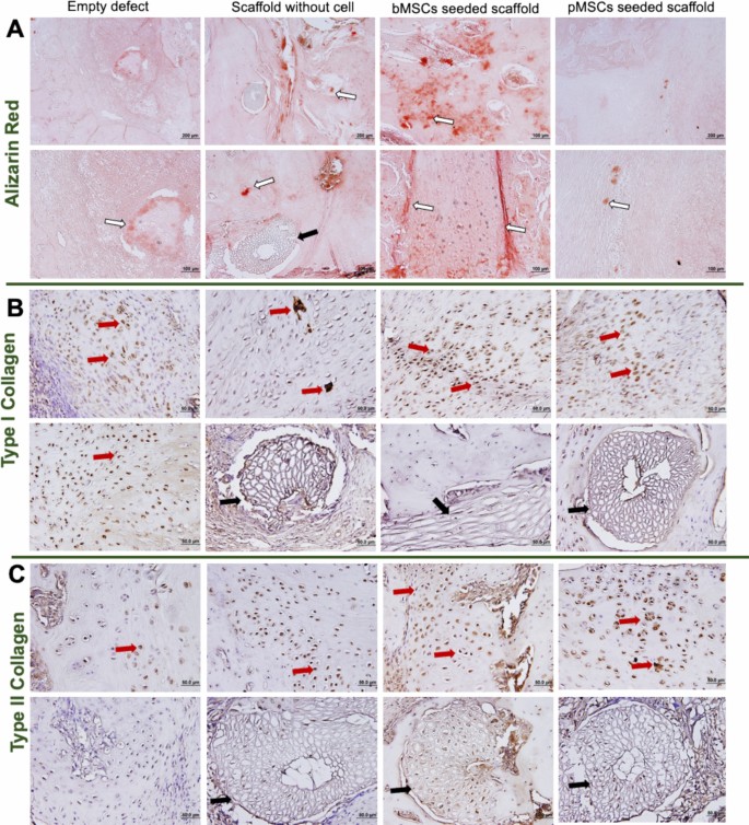Hydroxyapatite and Loofah-Reinforced Carboxymethyl Chitosan Hydrogel ...
