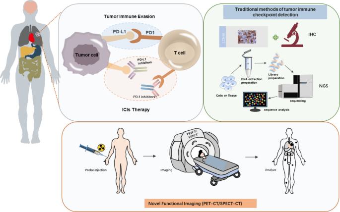 Detection of tumor immune checkpoints: from pathological analysis to ...
