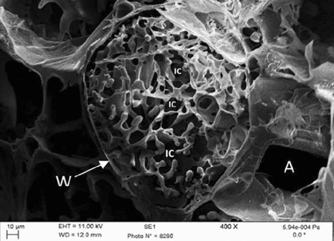 Electron microscopy and calorimetry of proteins in supercooled