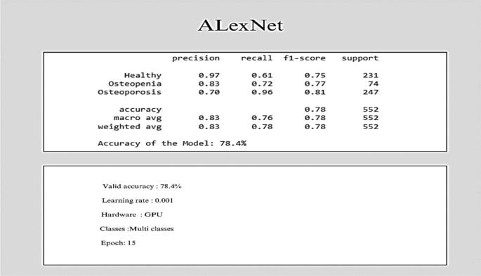 figure 21