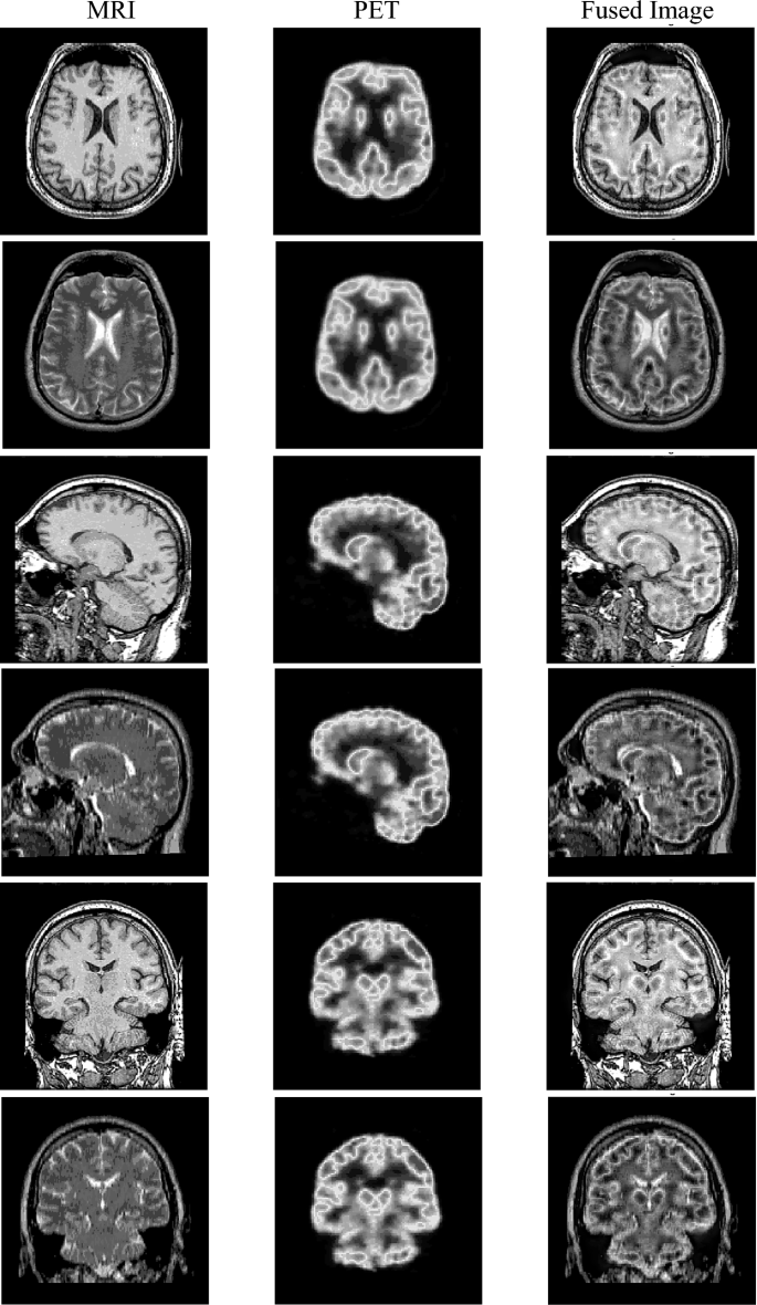 Fuse ssim (97) 사진