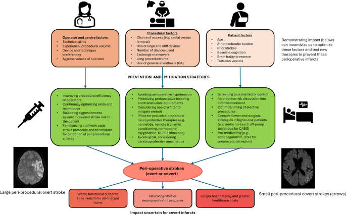 Perioperative Risks Perioperative strokes: uncovering risks, sequelae, and a therapeutic ...