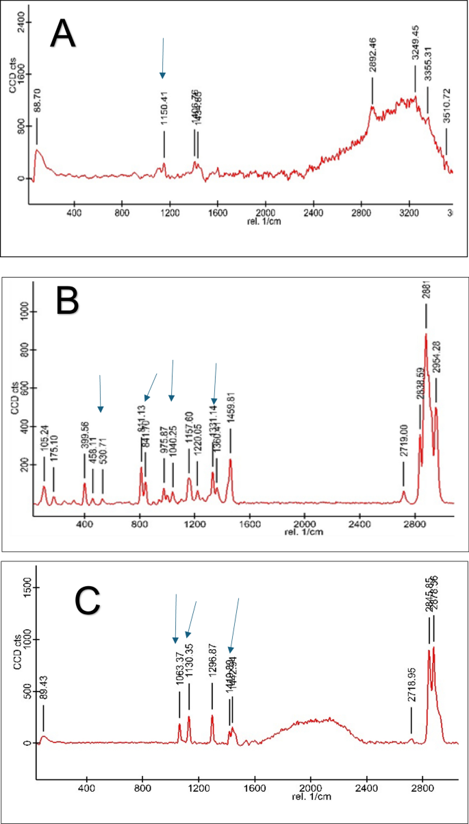 Occurrence and characterization of microplastics in bottled drinking water  | Discover Environment | Springer Nature Link