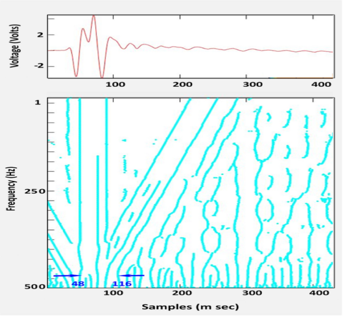 figure 11