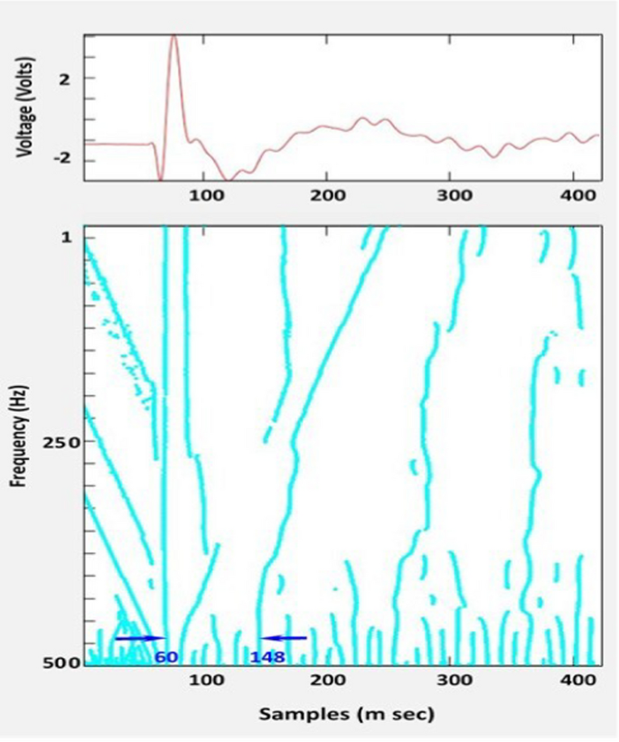 figure 15