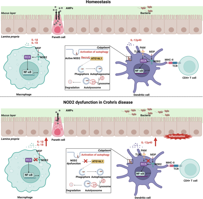 Unraveling the role of autophagy regulation in Crohn\u0026#39;s disease: from genetic mechanisms to ...