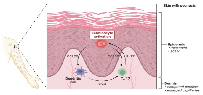 Exploring innovative therapeutic strategies for psoriasis treatment using  bioactive compounds | Discover Pharmaceutical Sciences