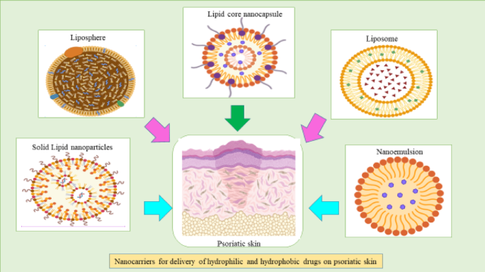 Exploring innovative therapeutic strategies for psoriasis treatment using  bioactive compounds | Discover Pharmaceutical Sciences
