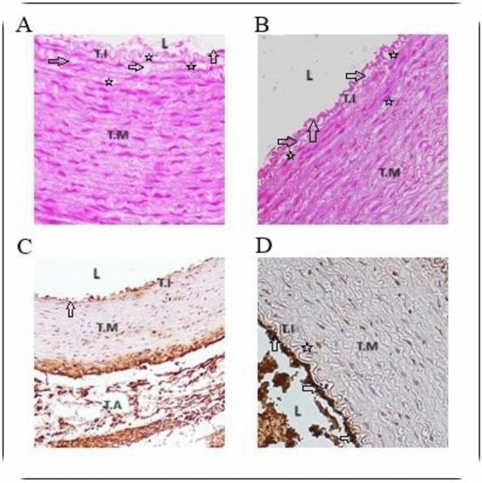Role of Urotensin II in Intrauterine Atherosclerosis in Rabbits ...