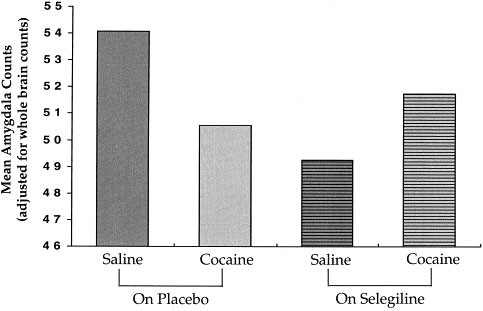 Selegiline Effects on Cocaine-Induced Changes in Medial Temporal Lobe Metabolism and Subjective Ratings of Euphoria | Neuropsychopharmacology Selegiline Effects on Cocaine-Induced Changes in Medial Temporal Lobe Metabolism and Subjective Ratings of Euphoria | Neuropsychopharmacology