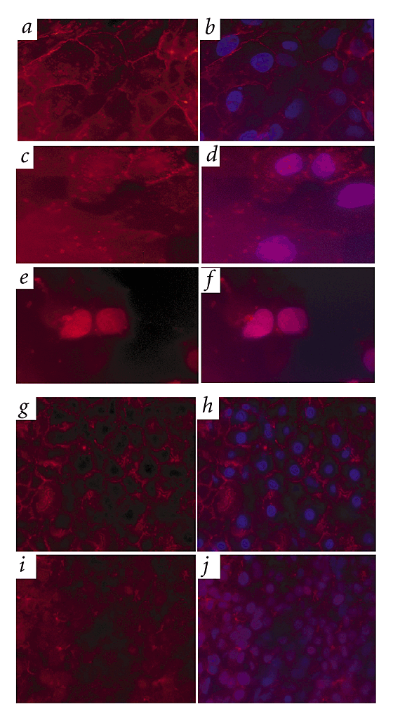 Axin1 Mutations In Hepatocellular Carcinomas And Growth Suppression In Cancer Cells By Virus Mediated Transfer Of Axin1 Nature Genetics Axin1 Mutations In Hepatocellular Carcinomas And Growth Suppression In Cancer Cells By Virus Mediated Transfer Of Axin1 Nature Genetics