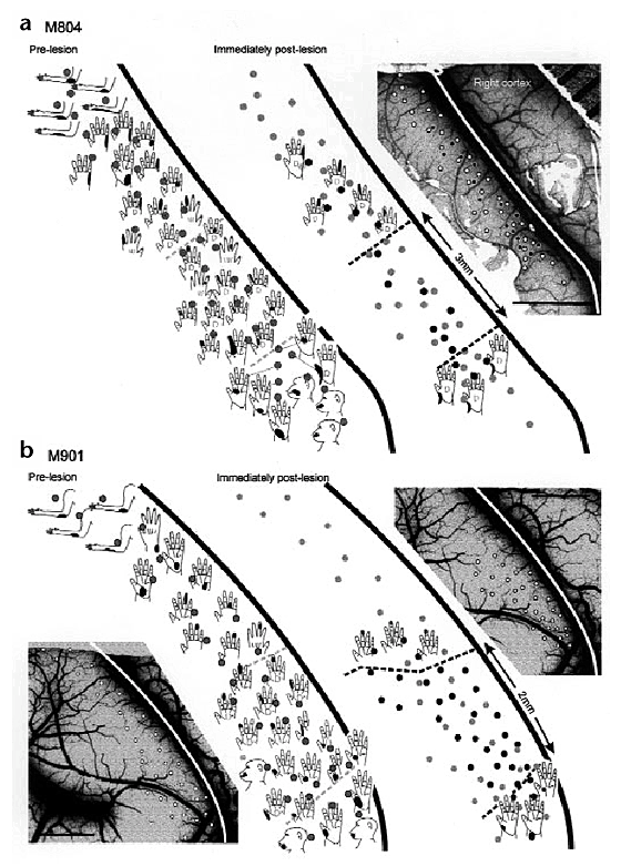 Functional changes at periphery and cortex following dorsal root lesions in adult monkeys | Nature Neuroscience Functional changes at periphery and cortex following dorsal root lesions in adult monkeys | Nature Neuroscience