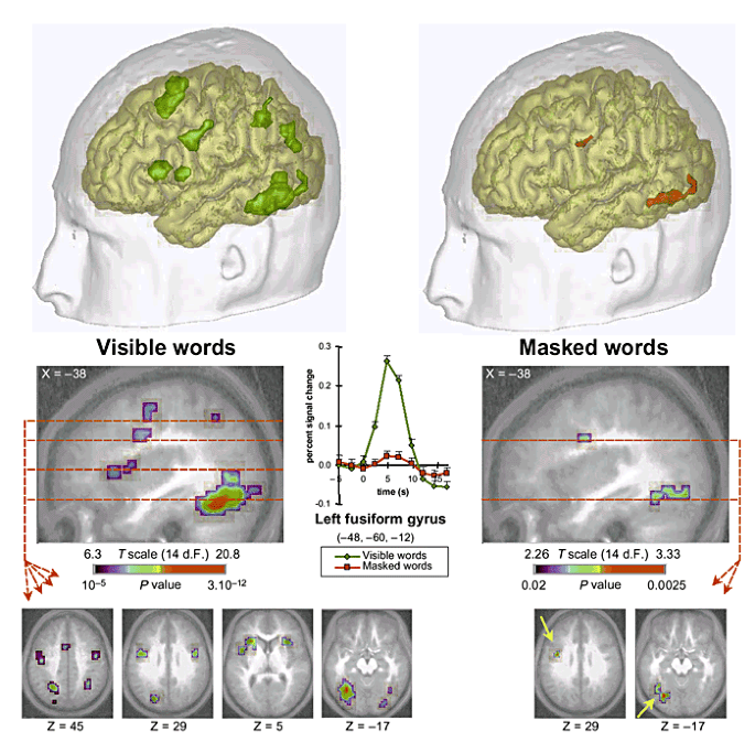 kristen Premier Manager Cerebral mechanisms of word masking and unconscious repetition priming |  Nature Neuroscience
