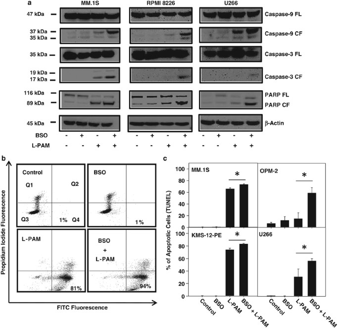 bso glutathione inhibitor The glutathione synthesis inhibitor buthionine sulfoximine synergistically  enhanced melphalan activity against preclinical models of multiple myeloma