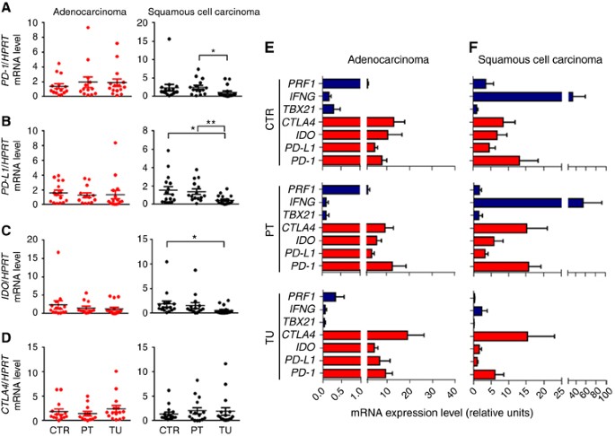 Impaired T-bet-pSTAT1α and perforin-mediated immune responses in the  tumoral region of lung adenocarcinoma | British Journal of Cancer