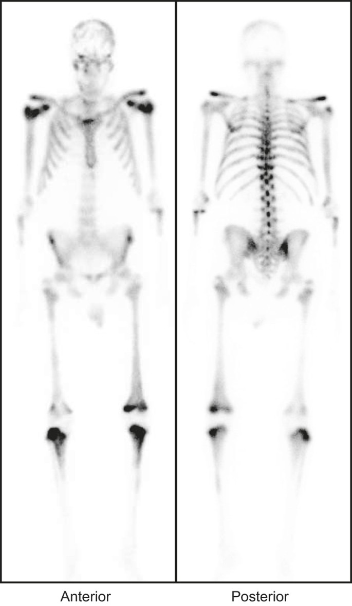 Contemporary for imaging metastasis | Bone Research