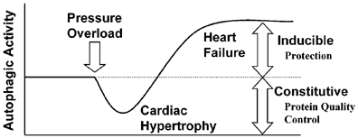 Distinct Roles of Autophagy in the Heart During Ischemia and Reperfusion