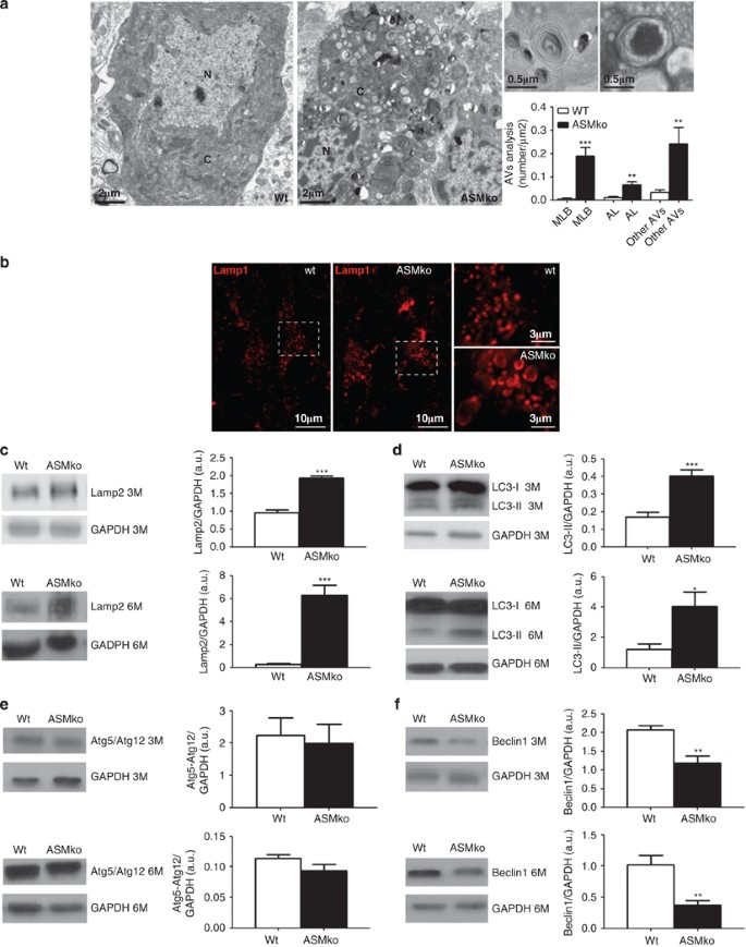 The pathogenesis of Niemann–Pick type C disease: a role for autophagy?, Expert Reviews in Molecular Medicine