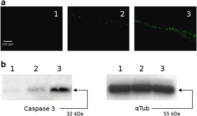 Carnitine reduces the lipoperoxidative damage of the membrane and apoptosis after induction of cell stress in experimental glaucoma