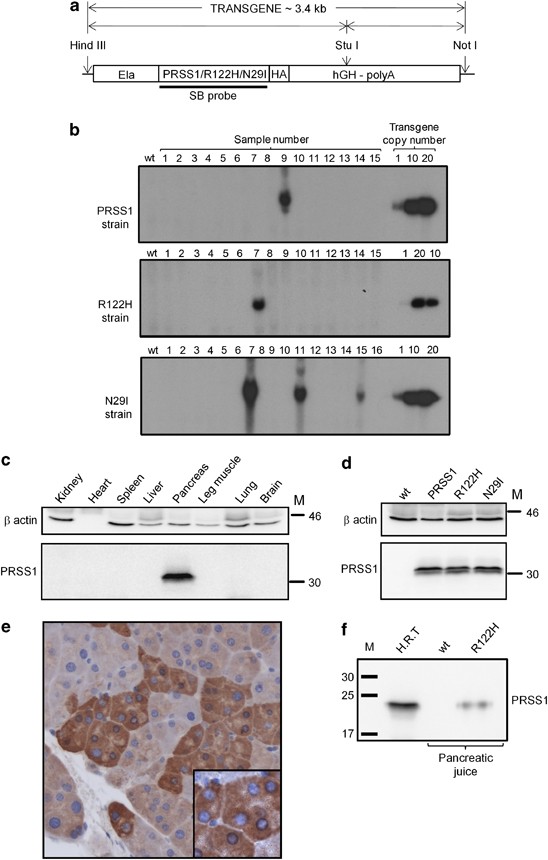 Expression Of Human Cationic Trypsinogen Prss1 In Murine Acinar Cells Promotes Pancreatitis And Apoptotic Cell Death Cell Death Disease