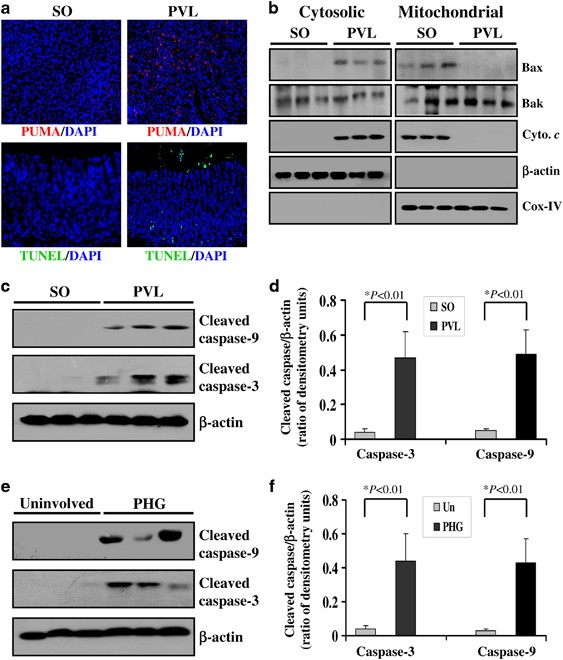 PUMA mediates ER stress-induced apoptosis in portal hypertensive  gastropathy | Cell Death & Disease