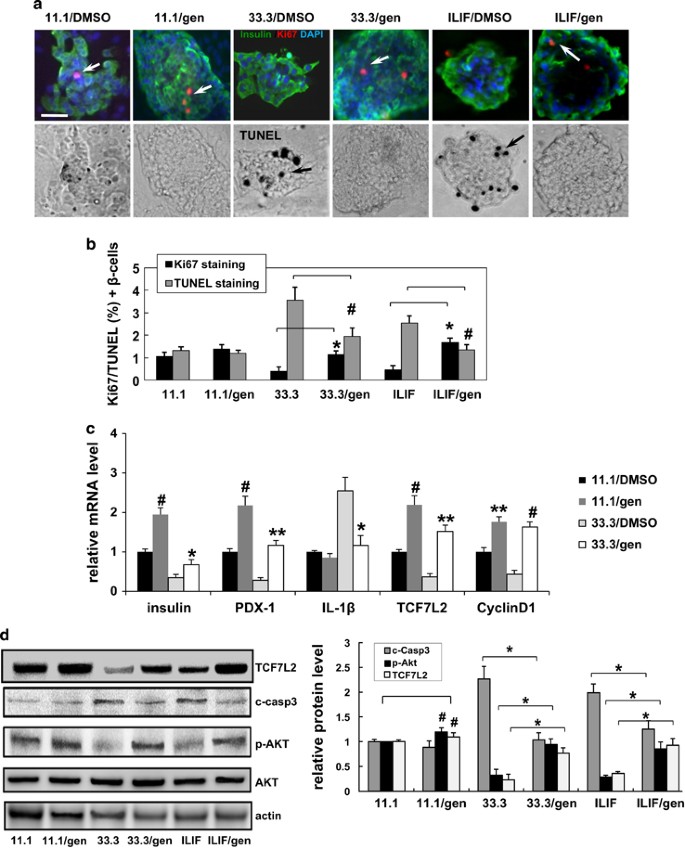 Geniposide Promotes Beta Cell Regeneration And Survival Through Regulating B Catenin Tcf7l2 Pathway Cell Death Disease