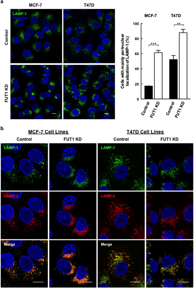 Fucosylation of LAMP-1 and LAMP-2 by FUT1 correlates with lysosomal  positioning and autophagic flux of breast cancer cells | Cell Death &  Disease