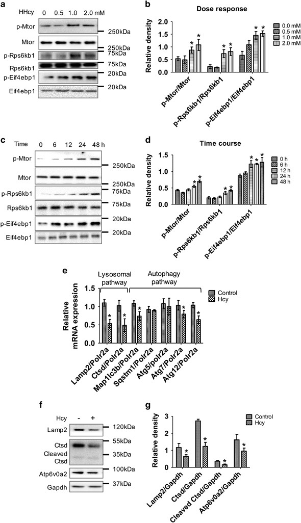 Hyperhomocysteinemia causes ER stress and impaired autophagy that 