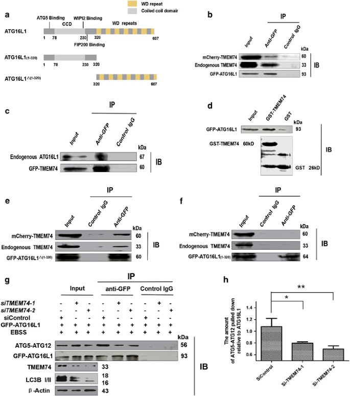 Tmem74 Promotes Tumor Cell Survival By Inducing Autophagy Via Interactions With Atg16l1 And Atg9a Cell Death Disease
