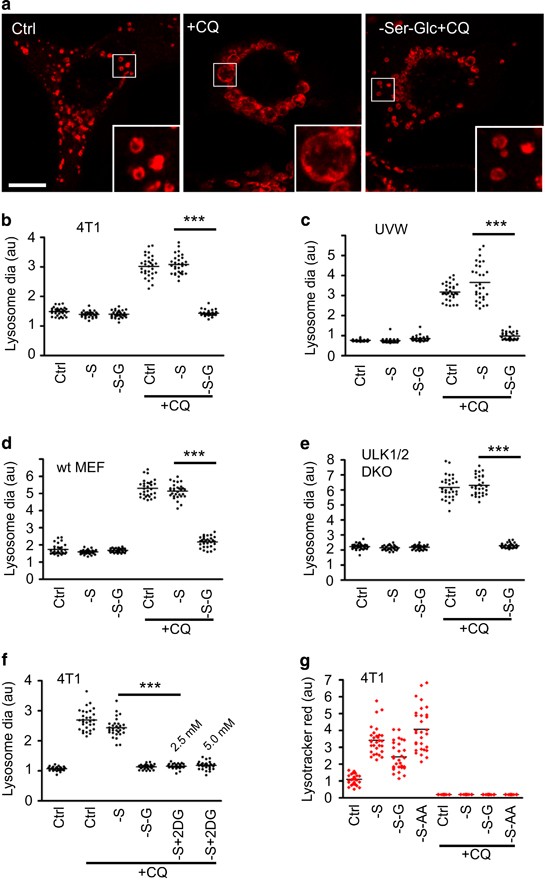 Lysosomotropism Depends On Glucose A Chloroquine Resistance Mechanism Cell Death Disease