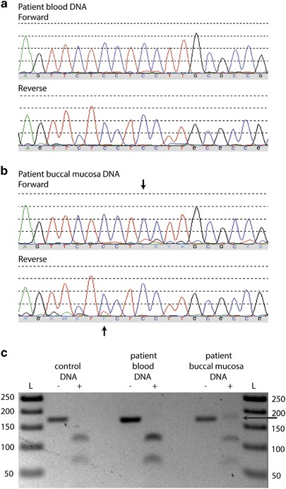 Ocular features in Rubinstein-Taybi syndrome: investigation of 24