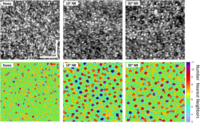 Variation in rod and cone density from the fovea to the mid-periphery in  healthy human retinas using adaptive optics scanning laser ophthalmoscopy |  Eye