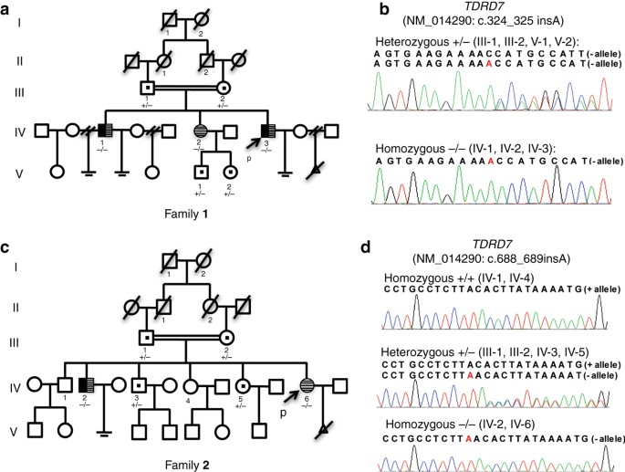 Figure 1: Pedigrees of the two consanguineous families with congenital cataract (CC) and nonobstructive azoospermia (NOA).