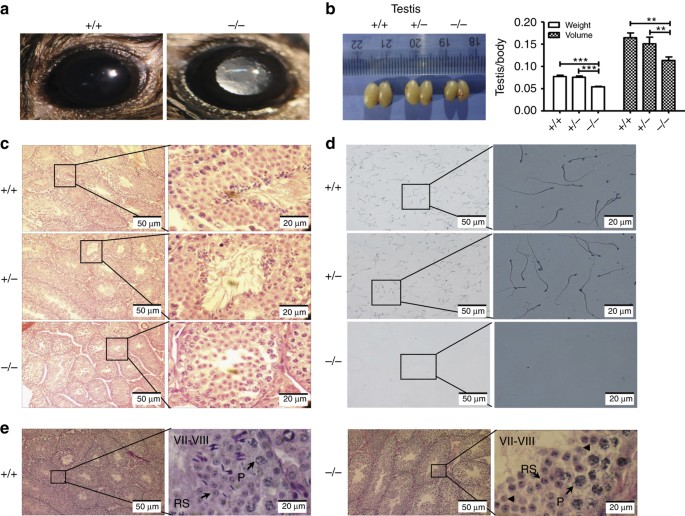 Figure 4: Phenotype analysis of Tdrd7-knockout mice.