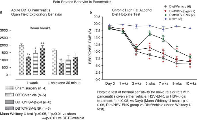 Gene Therapy For Pancreatitis Pain Gene Therapy