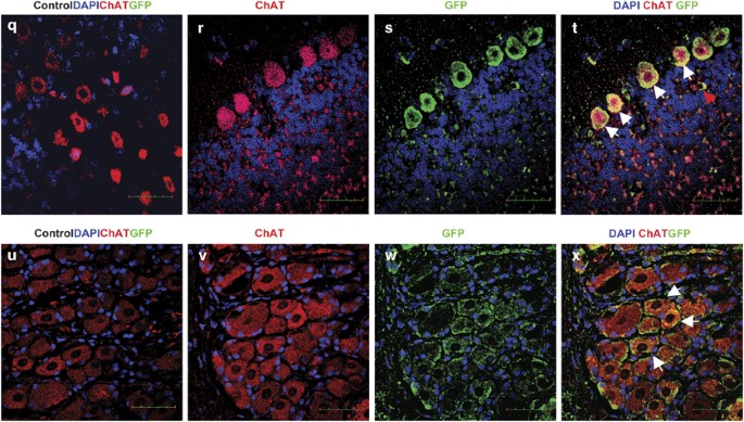Systemic Delivery Of Scaav9 In Fetal Macaques Facilitates Neuronal Transduction Of The Central And Peripheral Nervous Systems Gene Therapy