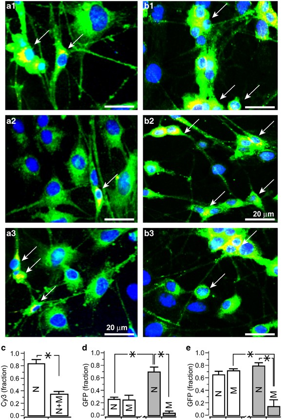 Innocuous Full Length Botulinum Neurotoxin Targets And Promotes The Expression Of Lentiviral Vectors In Central And Autonomic Neurons Gene Therapy