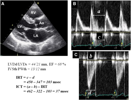 Left Ventricular Systolic Dysfunction
