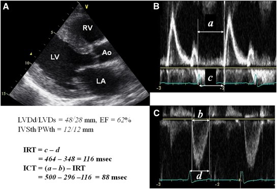 Left ventricular global systolic dysfunction has a significant role in the  development of diastolic heart failure in patients with systemic  hypertension