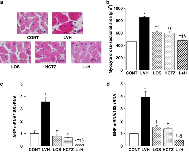 Mechanism Underlying The Efficacy Of Combination Therapy With Losartan And Hydrochlorothiazide In Rats With Salt Sensitive Hypertension Hypertension Research