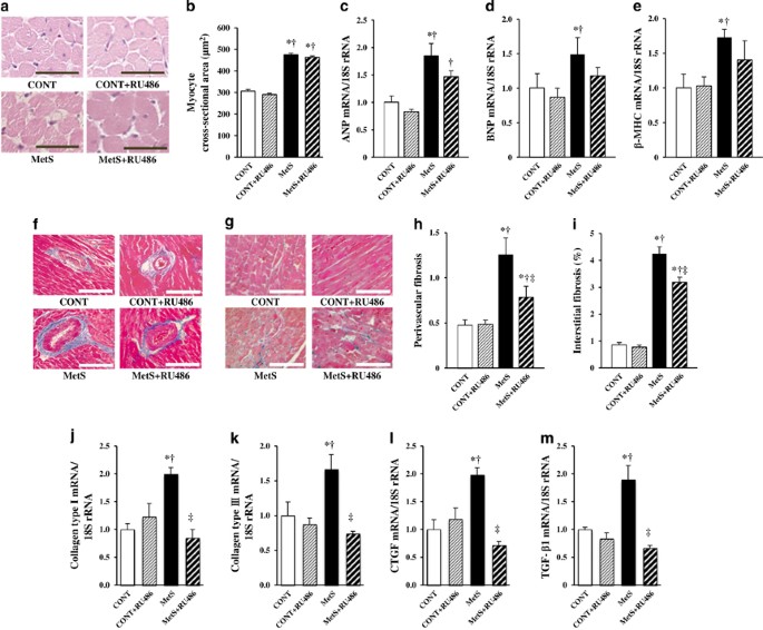Blockade Of Glucocorticoid Receptors With Ru486 Attenuates Cardiac Damage And Adipose Tissue Inflammation In A Rat Model Of Metabolic Syndrome Hypertension Research