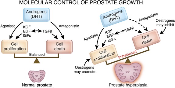 benign prostatic hyperplasia pathophysiology)