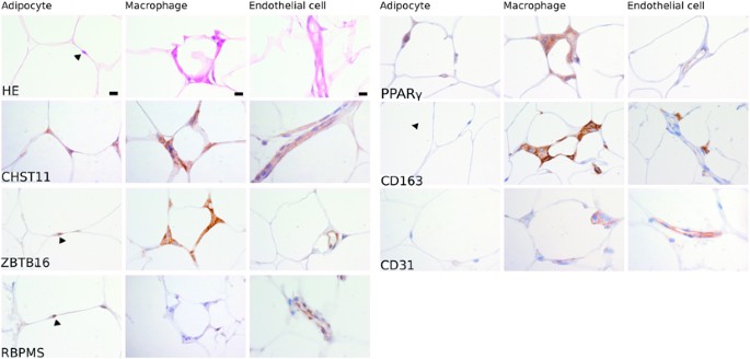 Dna Methylation And Gene Expression Patterns In Adipose Tissue Differ Significantly Within Young Adult Monozygotic Bmi Discordant Twin Pairs International Journal Of Obesity