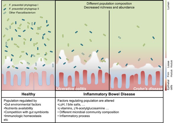 Faecalibacterium Prausnitzii From Microbiology To Diagnostics And Prognostics The Isme Journal