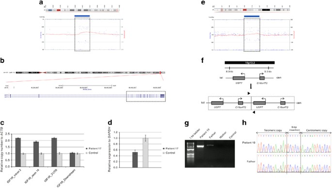 High frequency of copy number imbalances in Rubinstein–Taybi