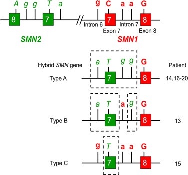 A new method for SMN1 and hybrid SMN gene analysis in spinal muscular  atrophy using long-range PCR followed by sequencing | Journal of Human  Genetics