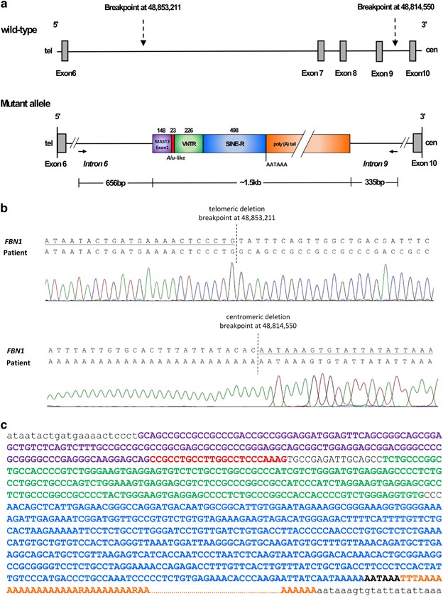 PDF) Identification of de novo EP300 and PLAU variants in a patient with  Rubinstein–Taybi syndrome-related arterial vasculopathy and skeletal anomaly