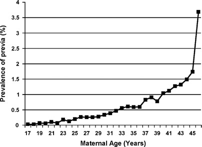 Racial And Ethnic Differences In The Prevalence Of Placenta Previa Journal Of Perinatology