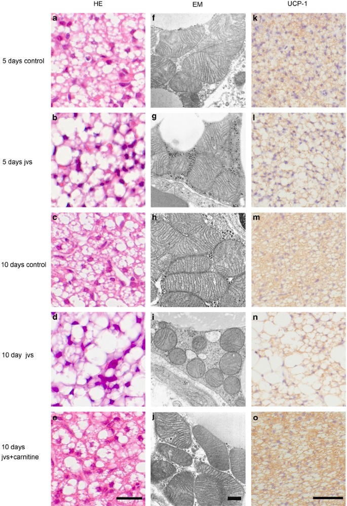 Carnitine is necessary to maintain the phenotype and function of brown  adipose tissue | Laboratory Investigation