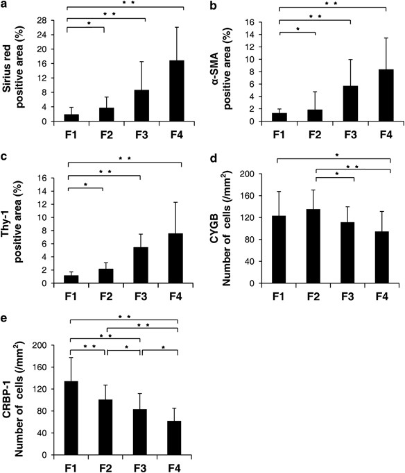 Cytoglobin Is Expressed In Hepatic Stellate Cells But Not In Myofibroblasts In Normal And Fibrotic Human Liver Laboratory Investigation